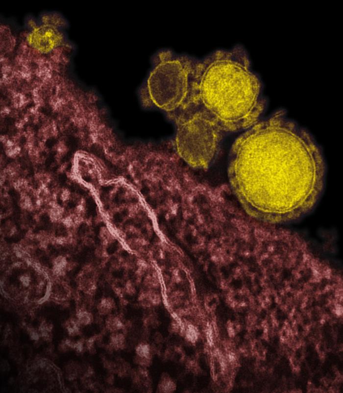 צילום של נגיף ה-MERS ממיקרוסקופ אלקטרונים סורק. צילום: National Institute of Allergy and Infectious Diseases (NIAID)